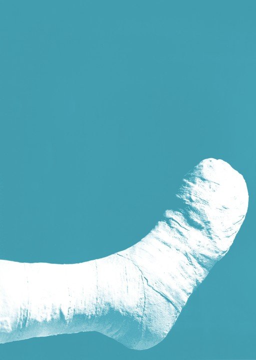 Foot Cast Against Teal Background